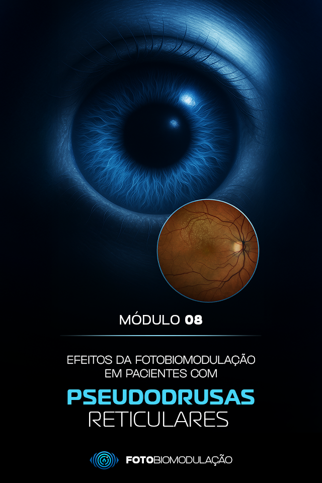 MOD 08